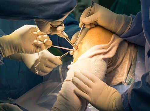 Dr. Habtewold working with surgical team